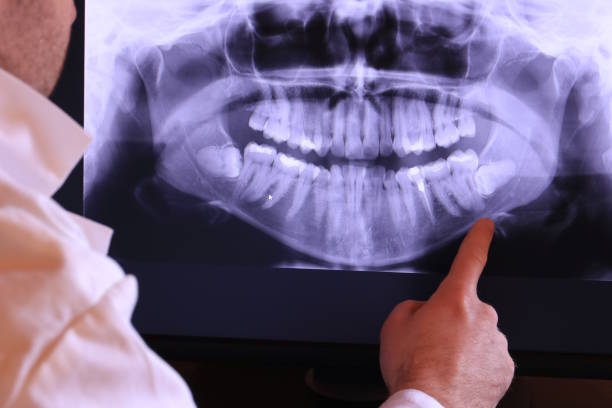 Best Emergency Treatment for Toothache in Sackets Harbor, NY